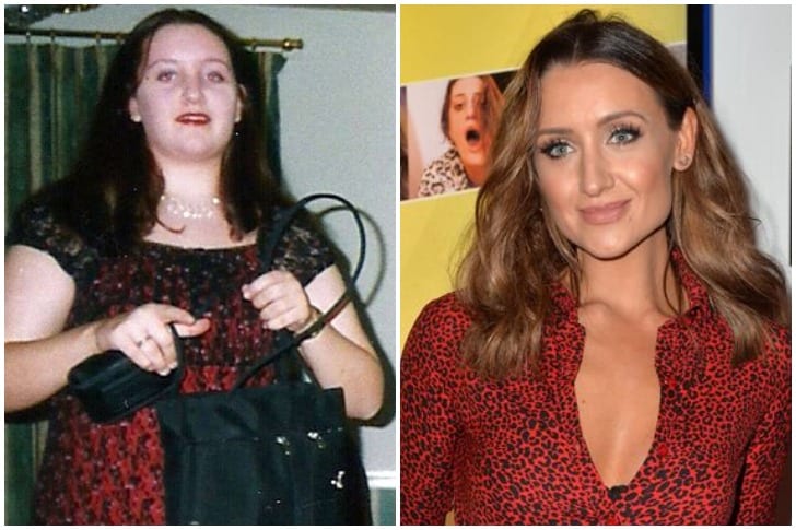 THESE CELEBRITIES LOOK WONDERFUL AFTER STUNNING WEIGHT LOSS ...